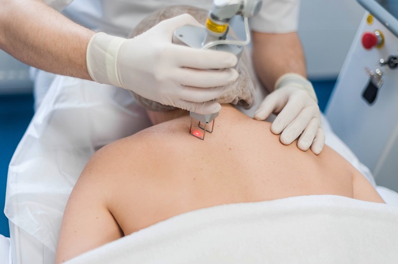 Cold Laser Therapy Orlando